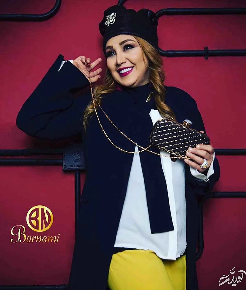 این خانم بازیگر رکورددار جراحی زیبایی ایرانی ! + تصاویری افشاگر !